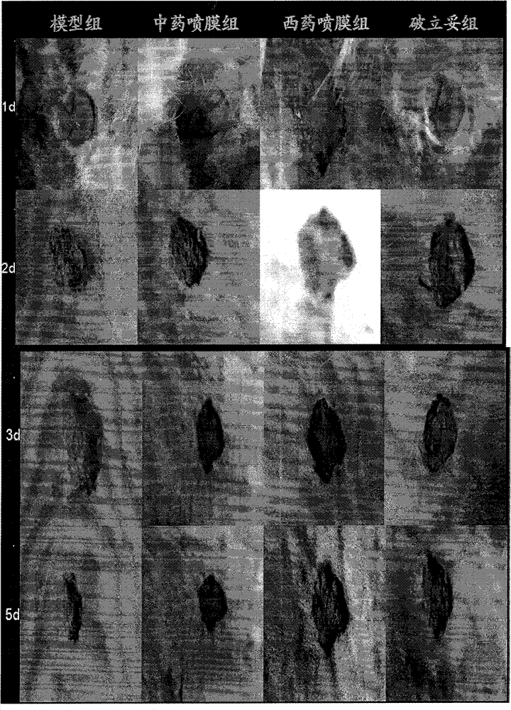 Novel membrane spraying preparation for skin trauma and preparation method