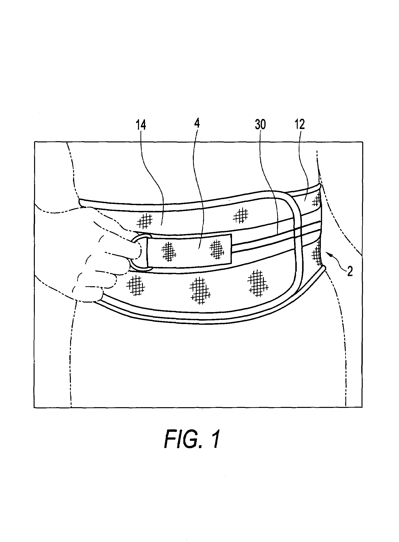 Orthosis closure system with mechanical advantage