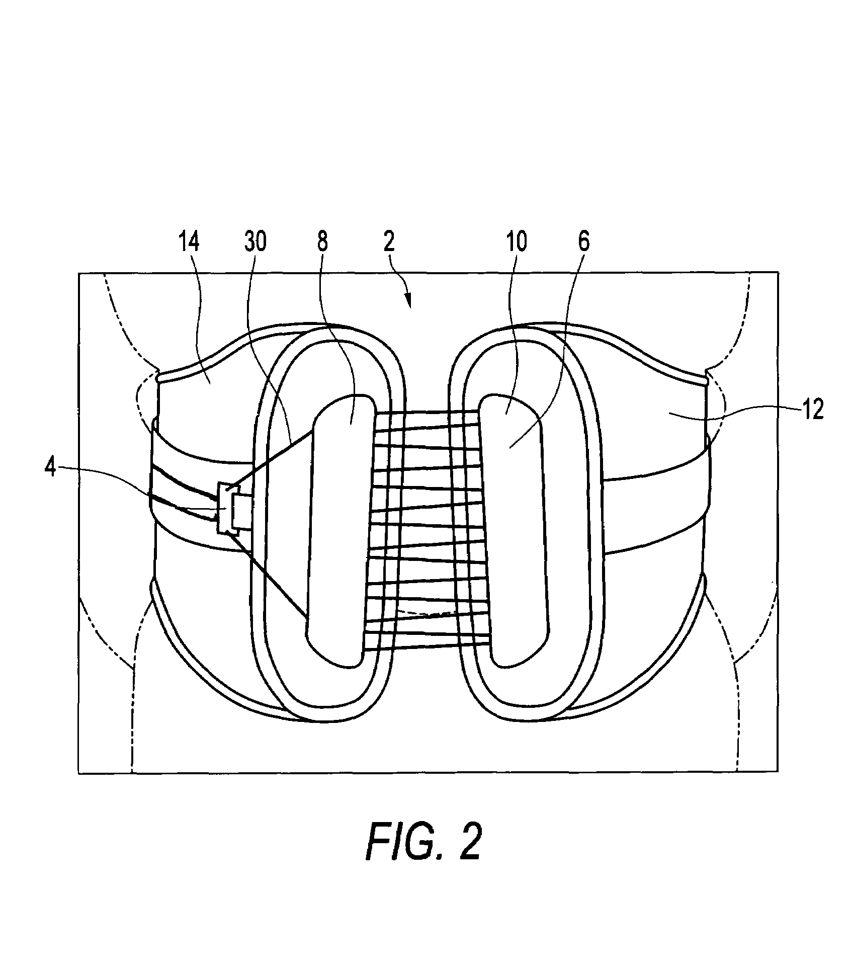 Orthosis closure system with mechanical advantage