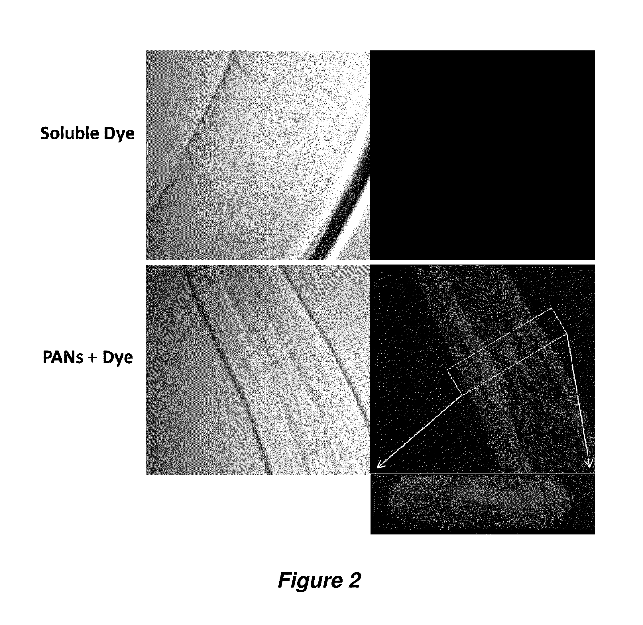 Antiparasitic polyanhydride nanoparticles