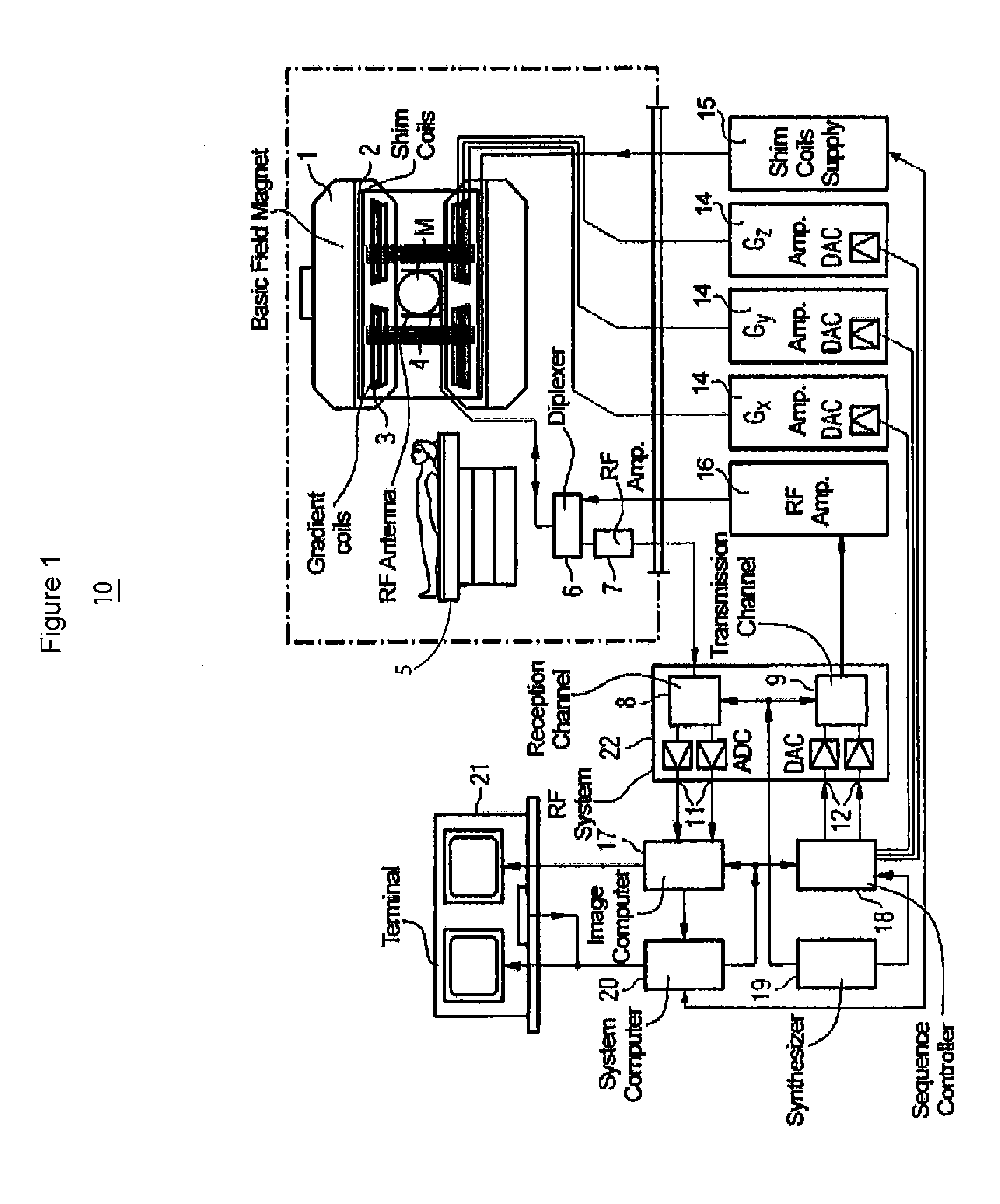 Automatic or Semi-Automatic Whole Body MR Scanning System