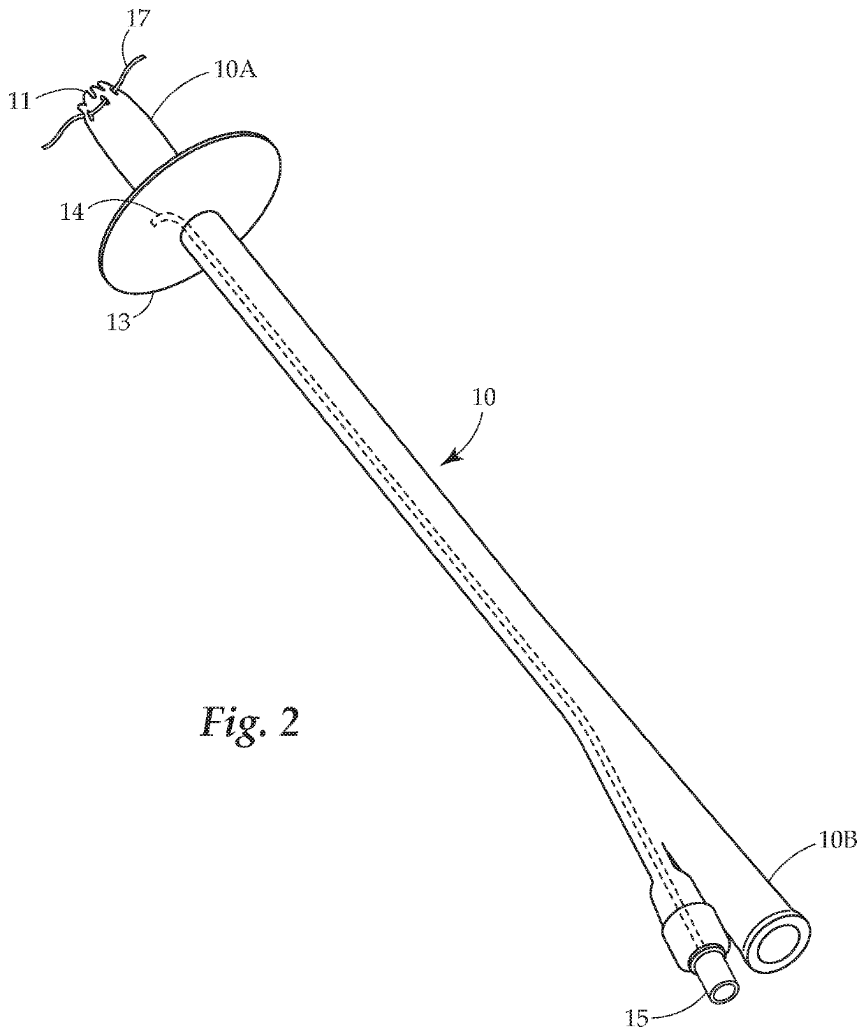 Enterostomy drainage methods and devices