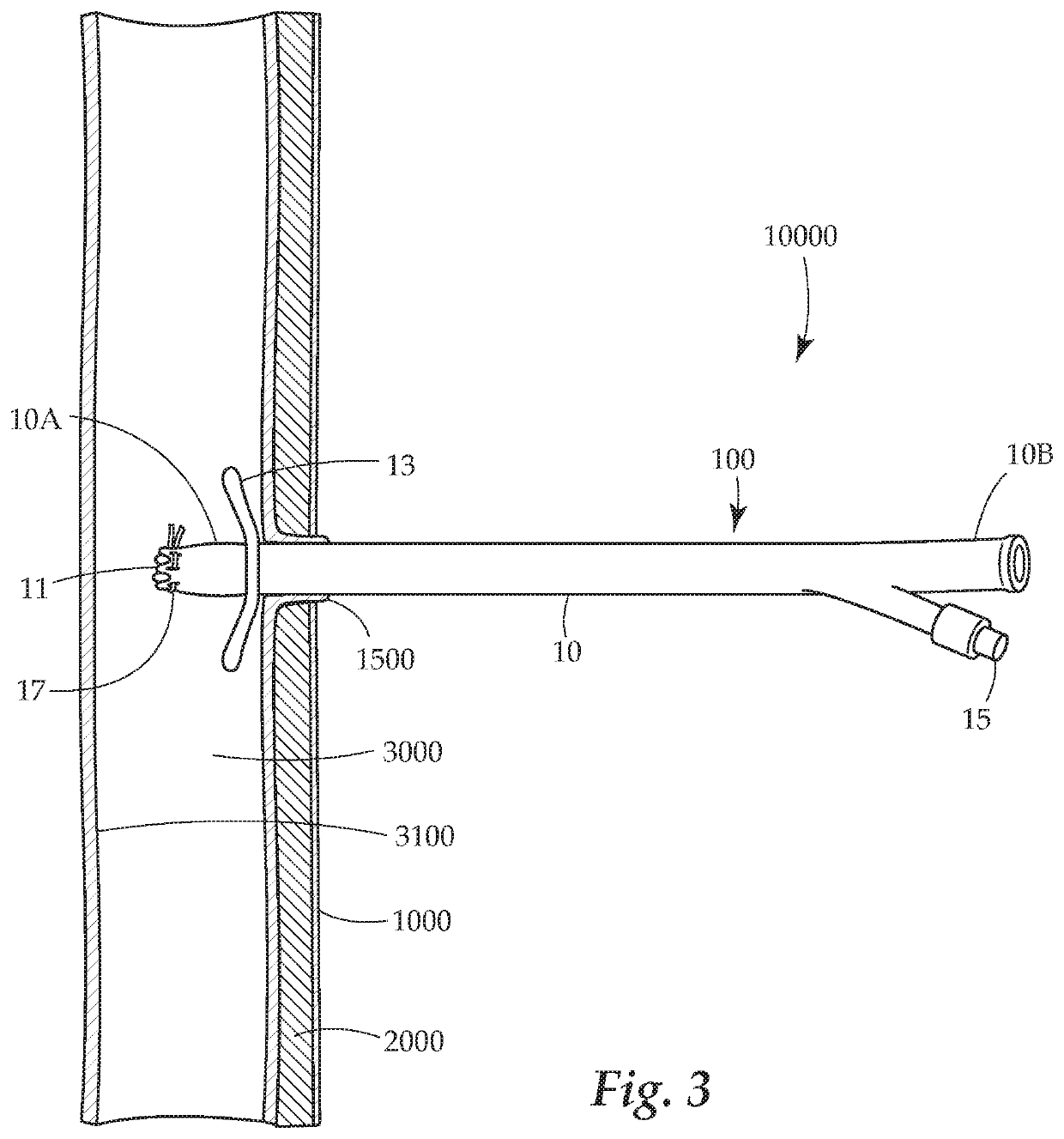 Enterostomy drainage methods and devices