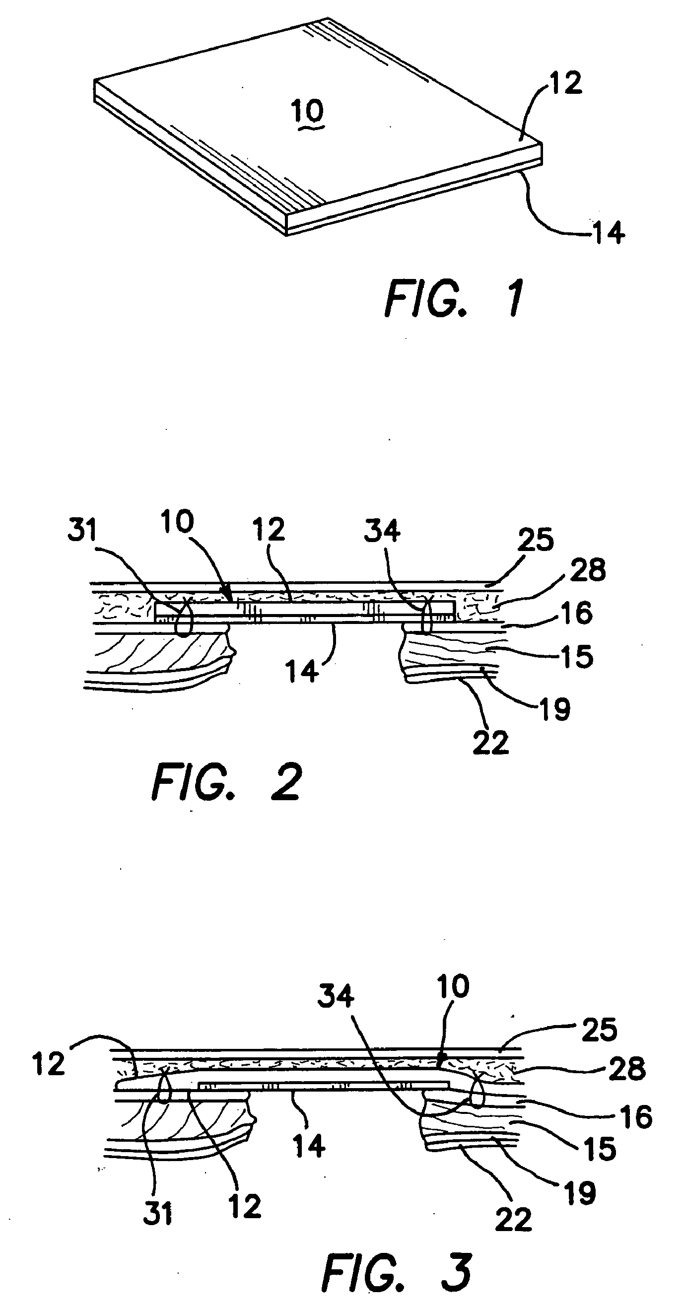 Surgical prosthesis having biodegradable and nonbiodegradable regions