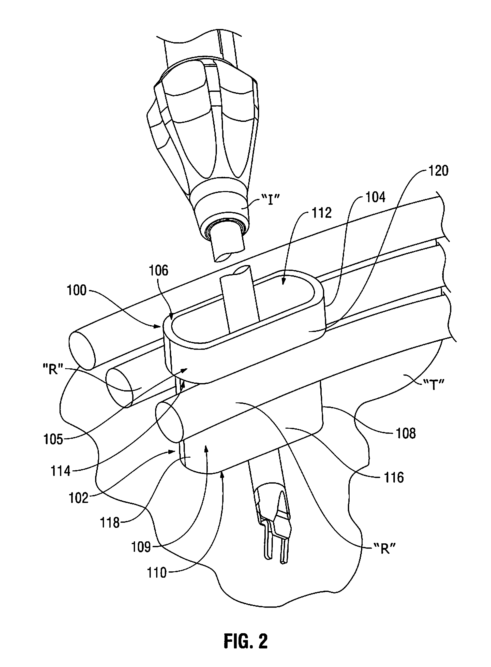 Pressure feedback access ports for minimally invasive surgery