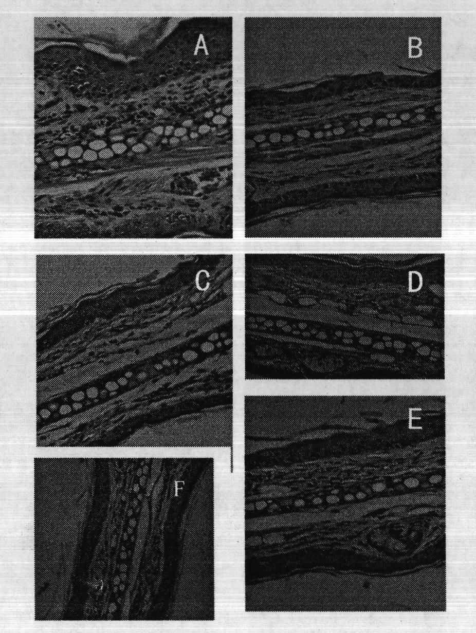 Traditional Chinese medicine preparation for preventing and treating infantile eczema and preparation method thereof