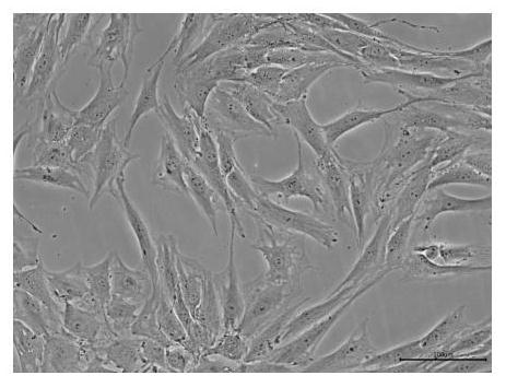 A method for isolating nucleus pulposus primary cells