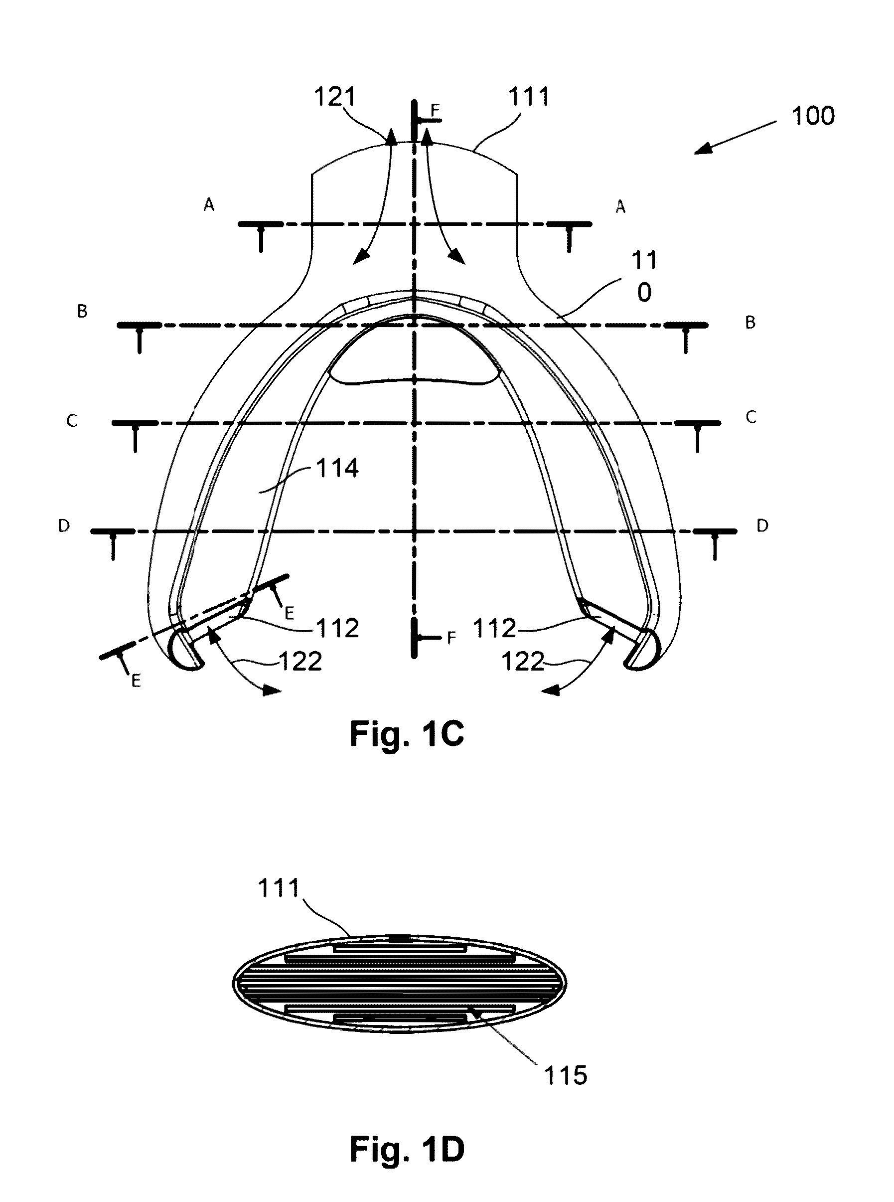 Breathing assist device