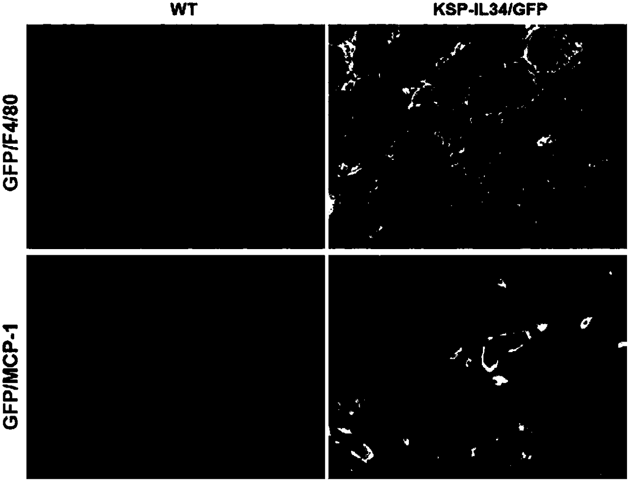 Method for constructing kidney persistent innate macrophage infiltration rat model