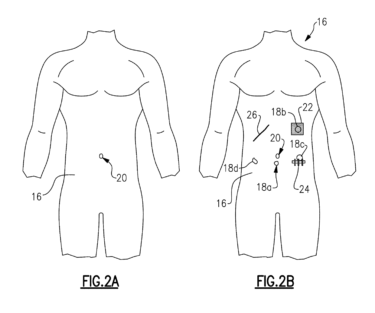 Surgical training apparatus, methods and systems