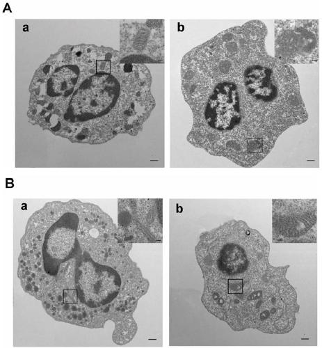 Drug for treating systemic lupus erythematosus