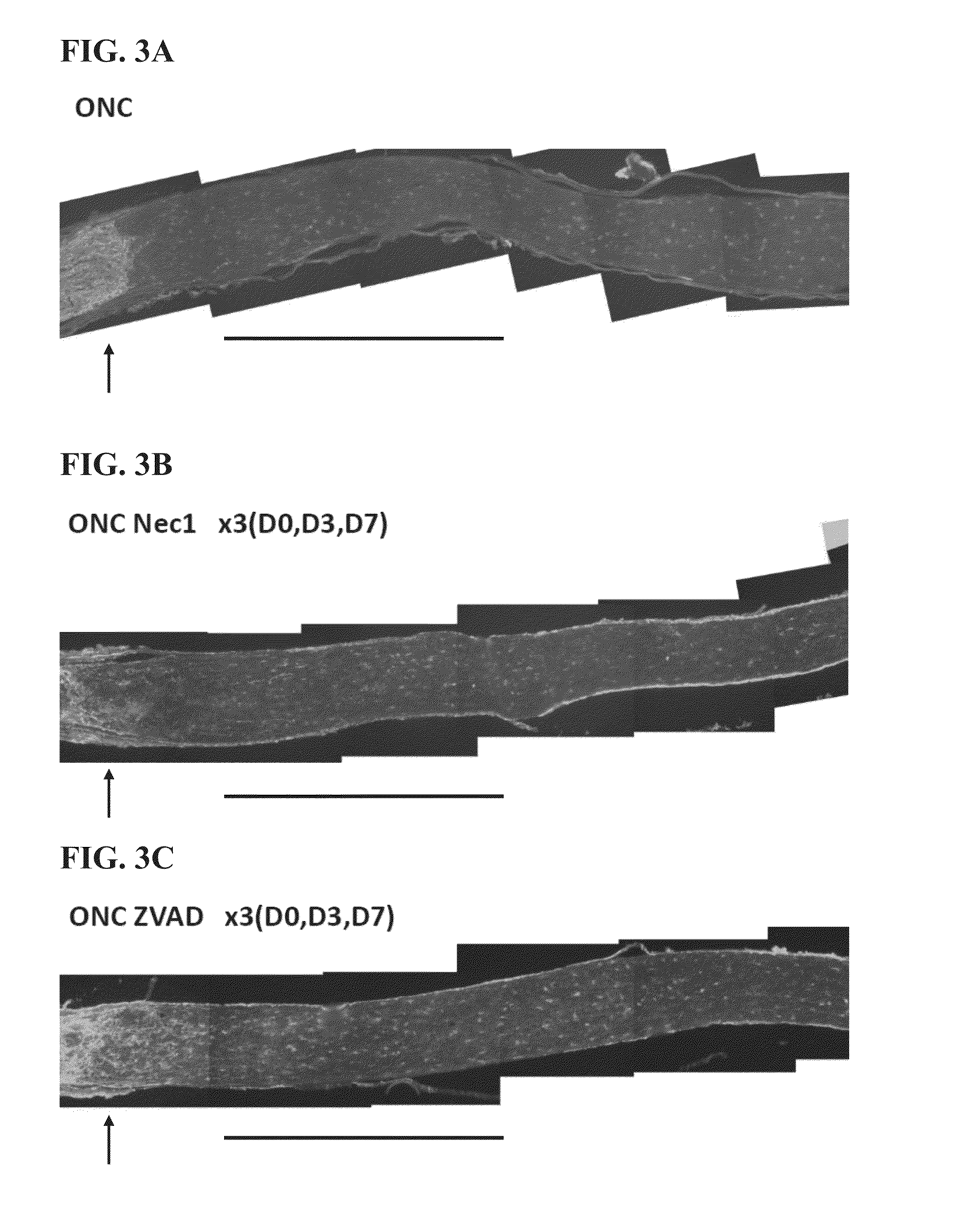 Compositions comprising necrosis inhibitors, such as necrostatins, alone or in combination, for promoting axon regeneration and nerve function, thereby treating CNS disorders