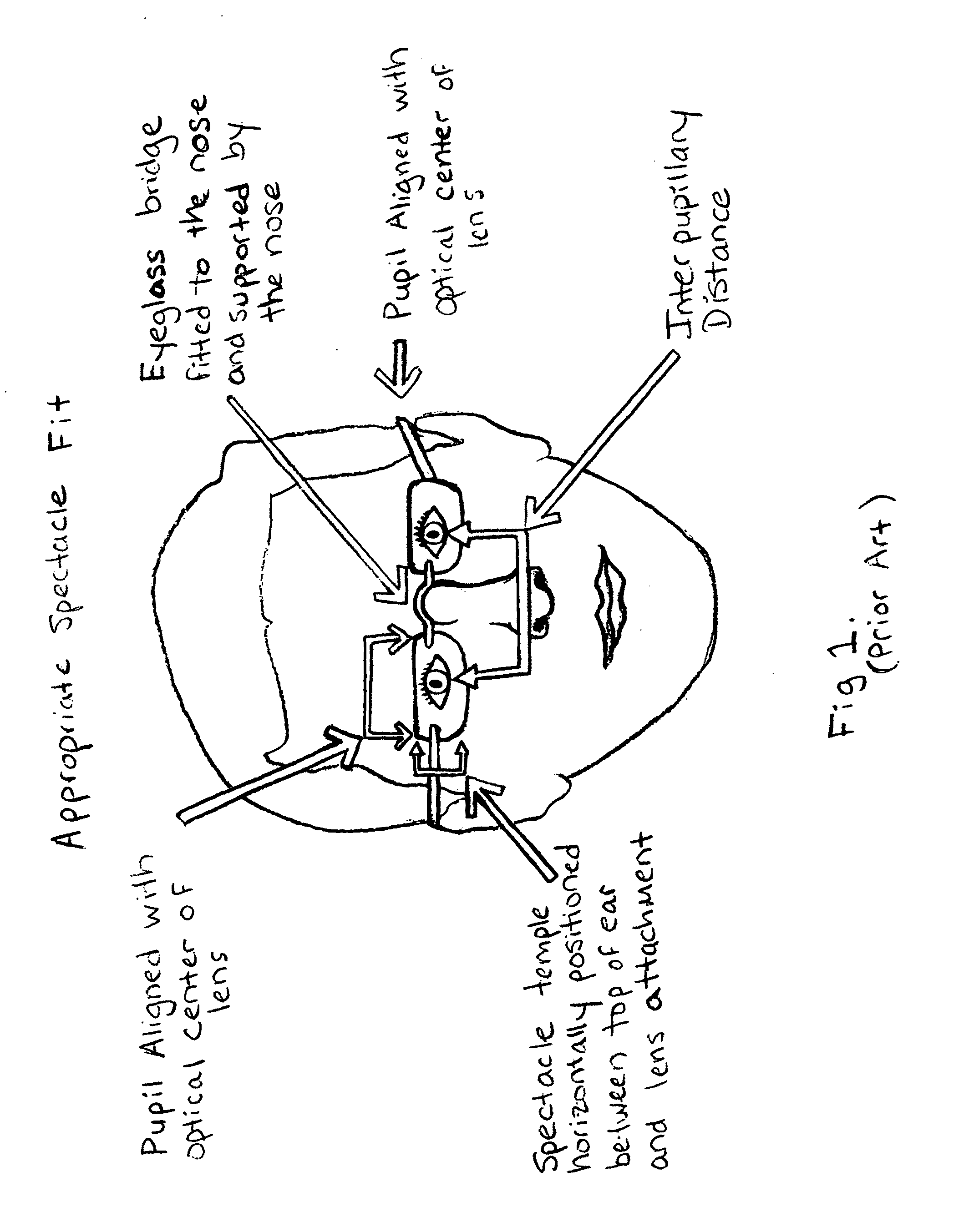 Spectacle assembly for faces without a prominent upper nasal support