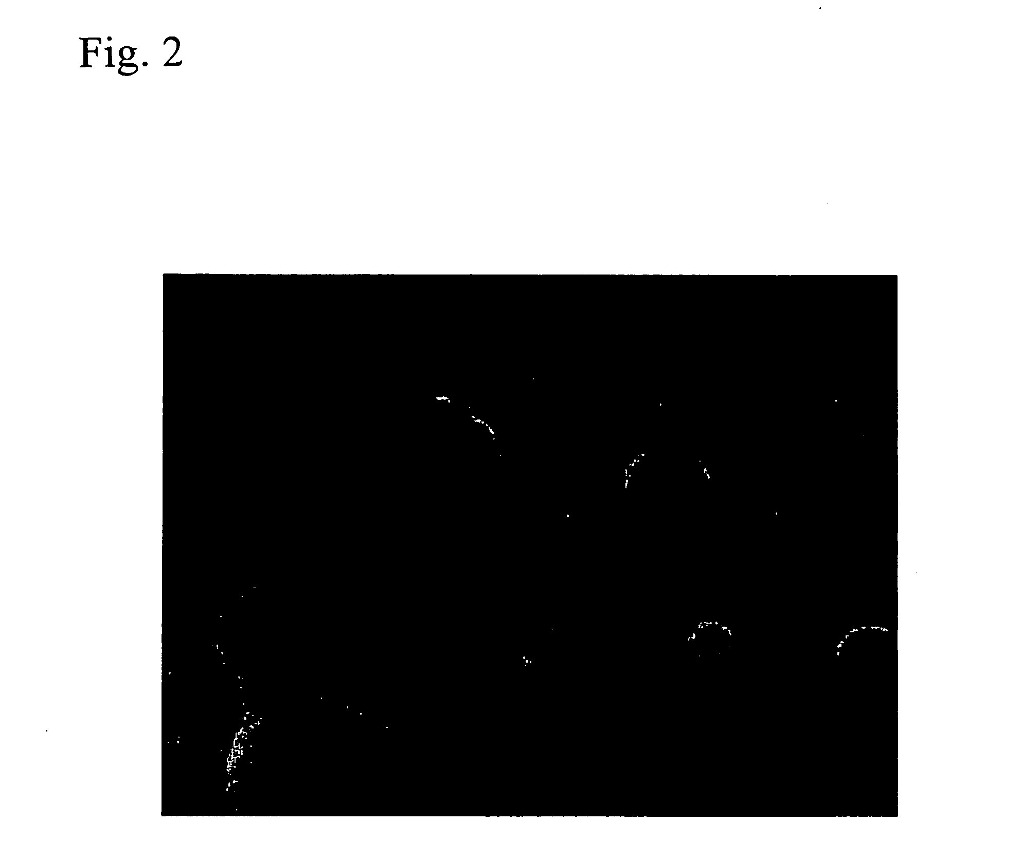 Carbon composite materials comprising particles of metal carbides dispersed therein and method for producing the same