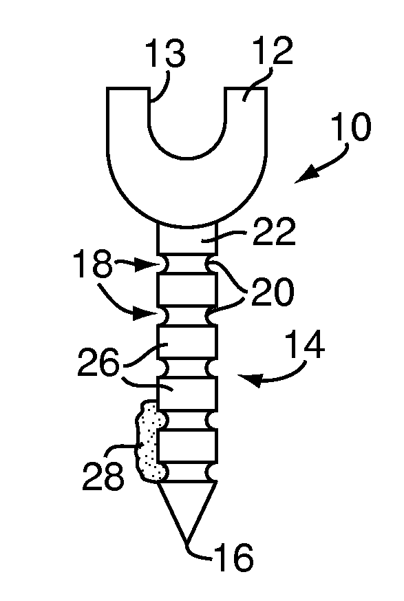 Methods and devices for spinal fusion