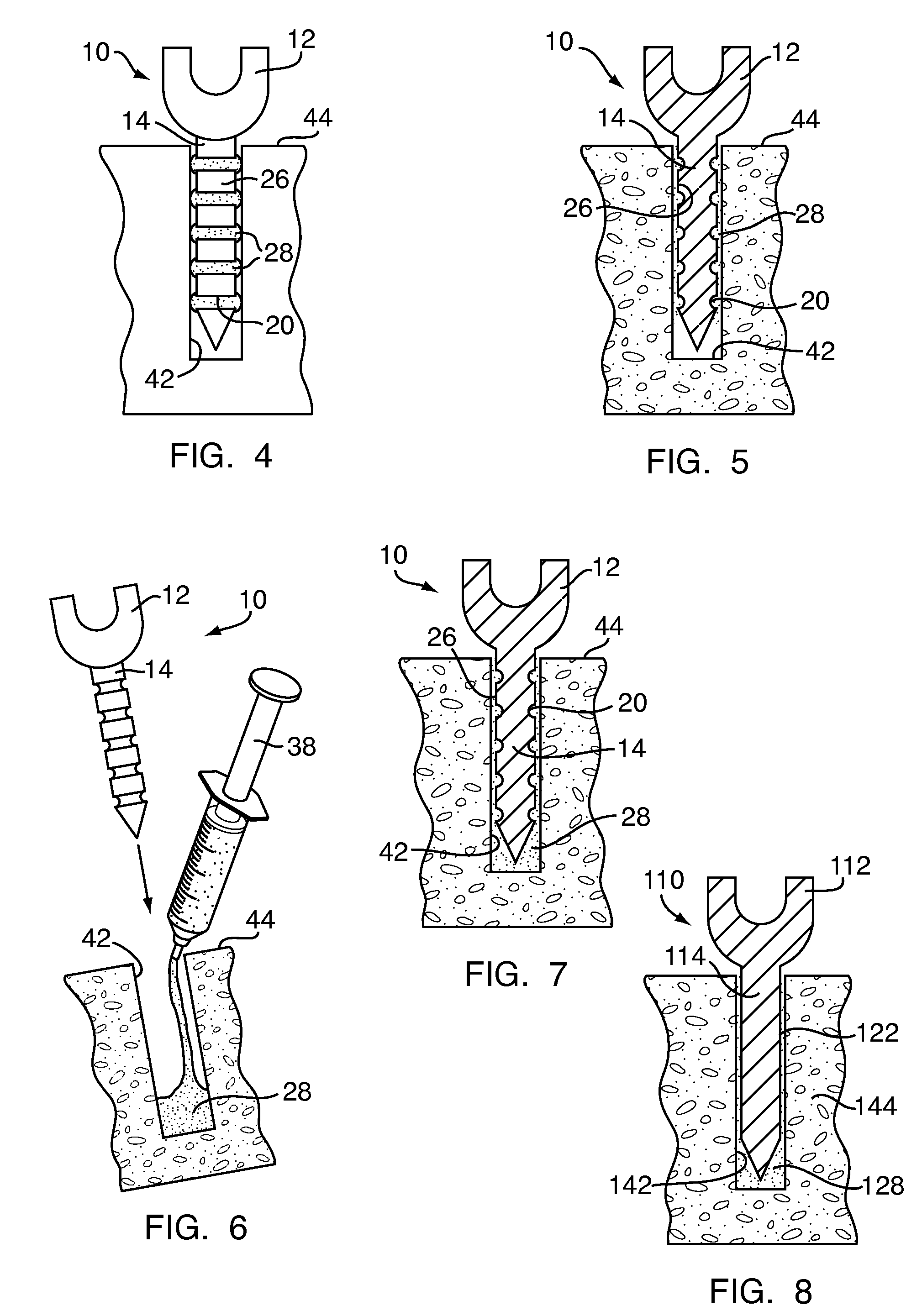 Methods and devices for spinal fusion