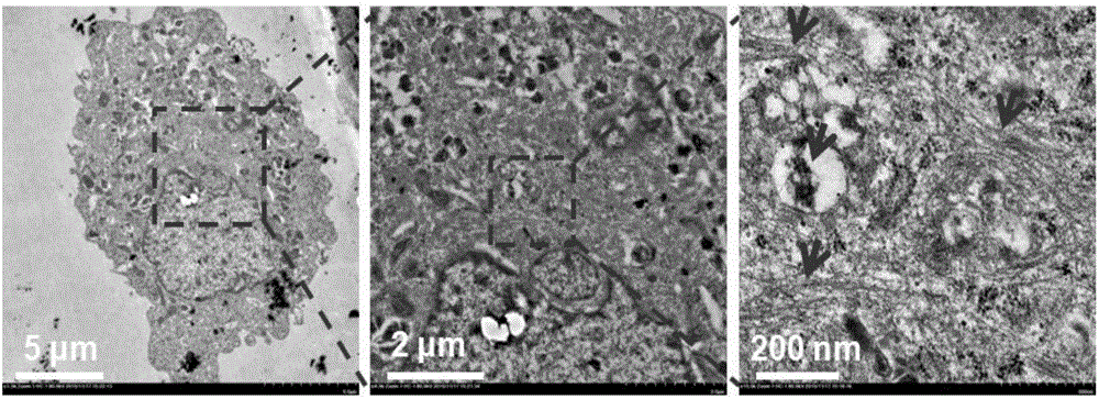 Polypeptide lipidosome capable of transforming shape in lysosome of tumor cell