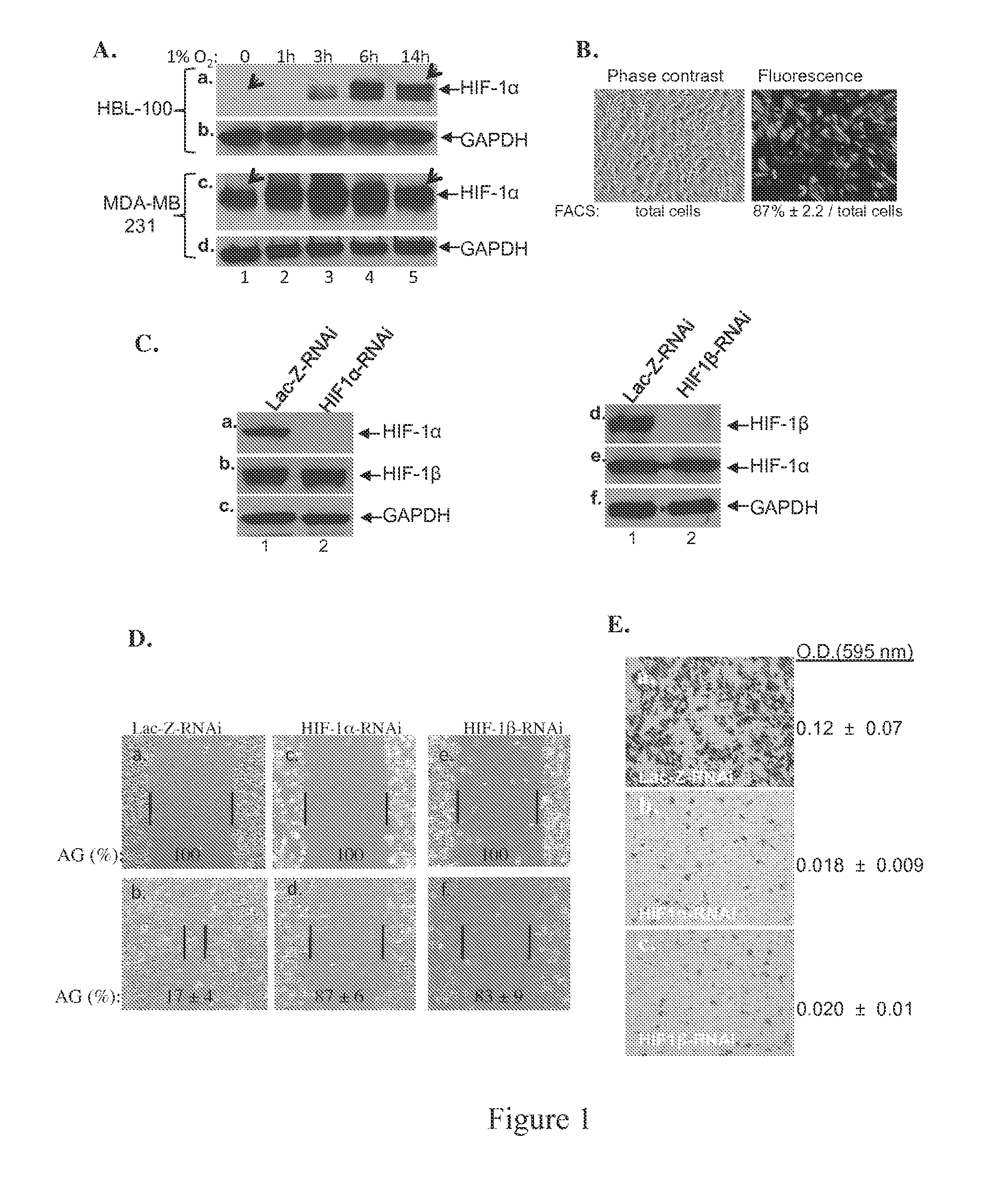 Fragment of secreted heat shock protein-90alpha (hsp90alpha) as vaccines or epitope for monoclonal antibody drugs or target for small molecule drugs against a range of solid human tumors