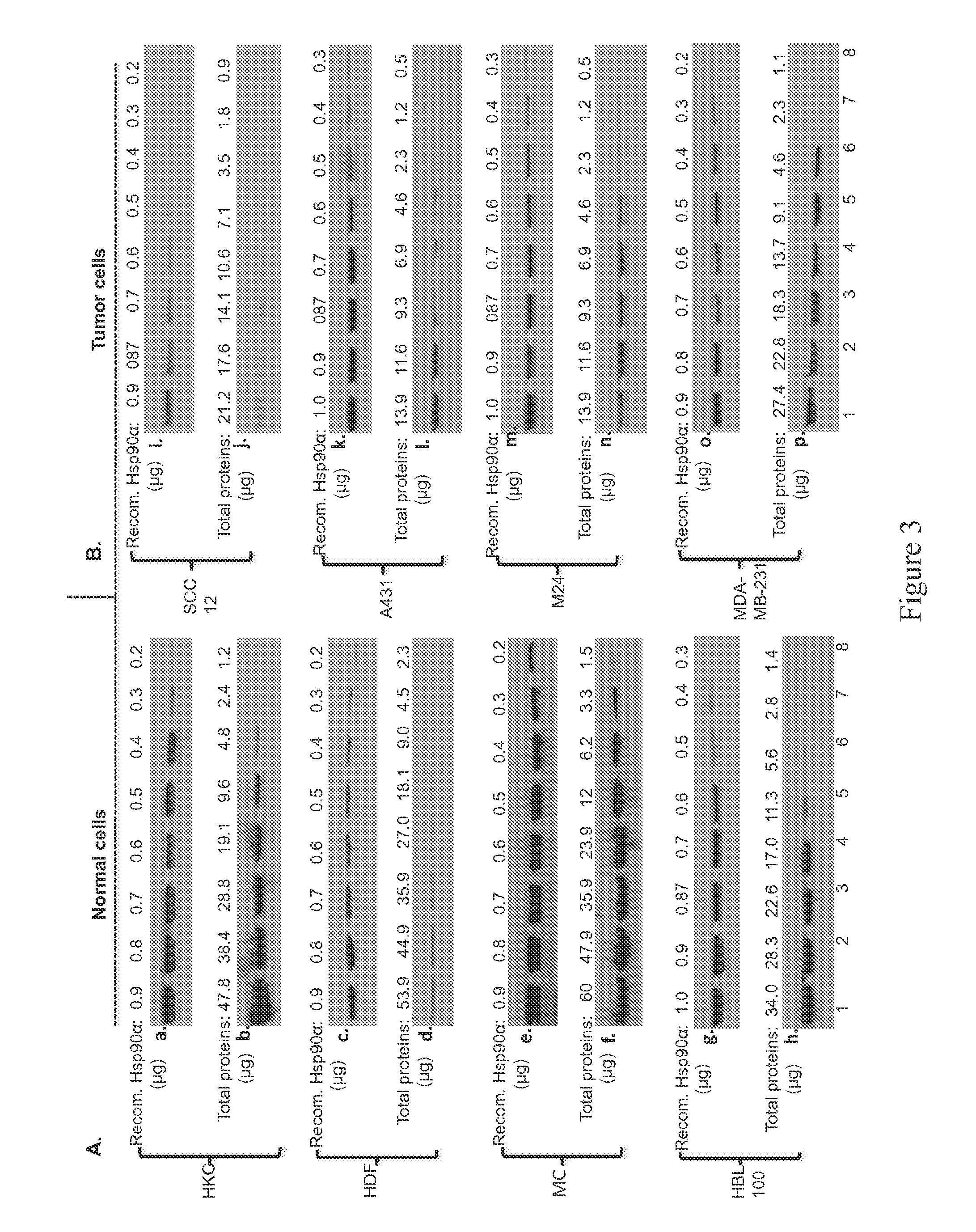 Fragment of secreted heat shock protein-90alpha (hsp90alpha) as vaccines or epitope for monoclonal antibody drugs or target for small molecule drugs against a range of solid human tumors