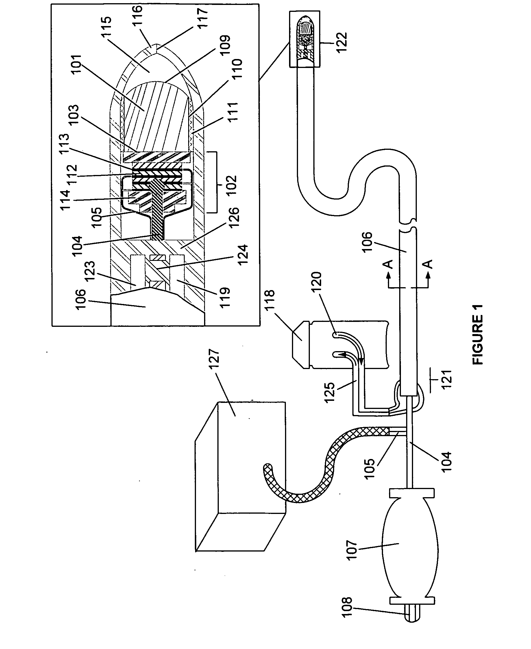 Ablative ultrasonic-cryogenic apparatus