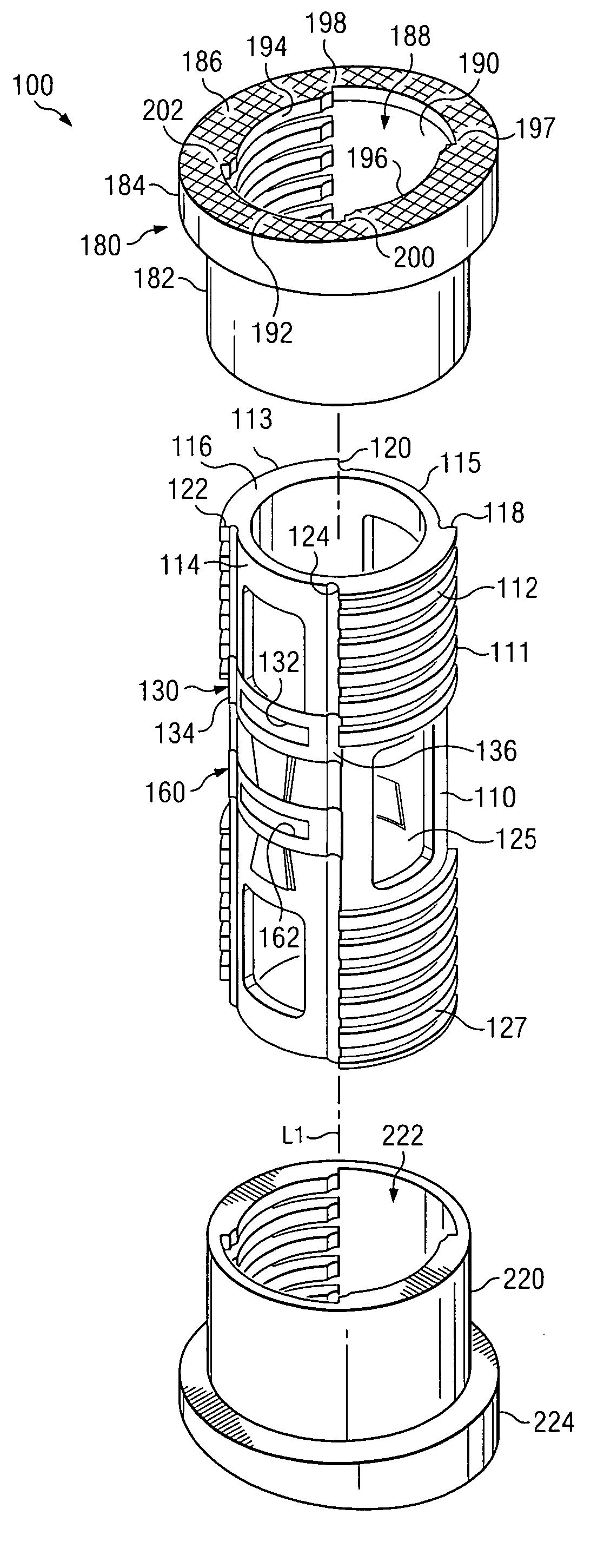 Locking expandable implant and method