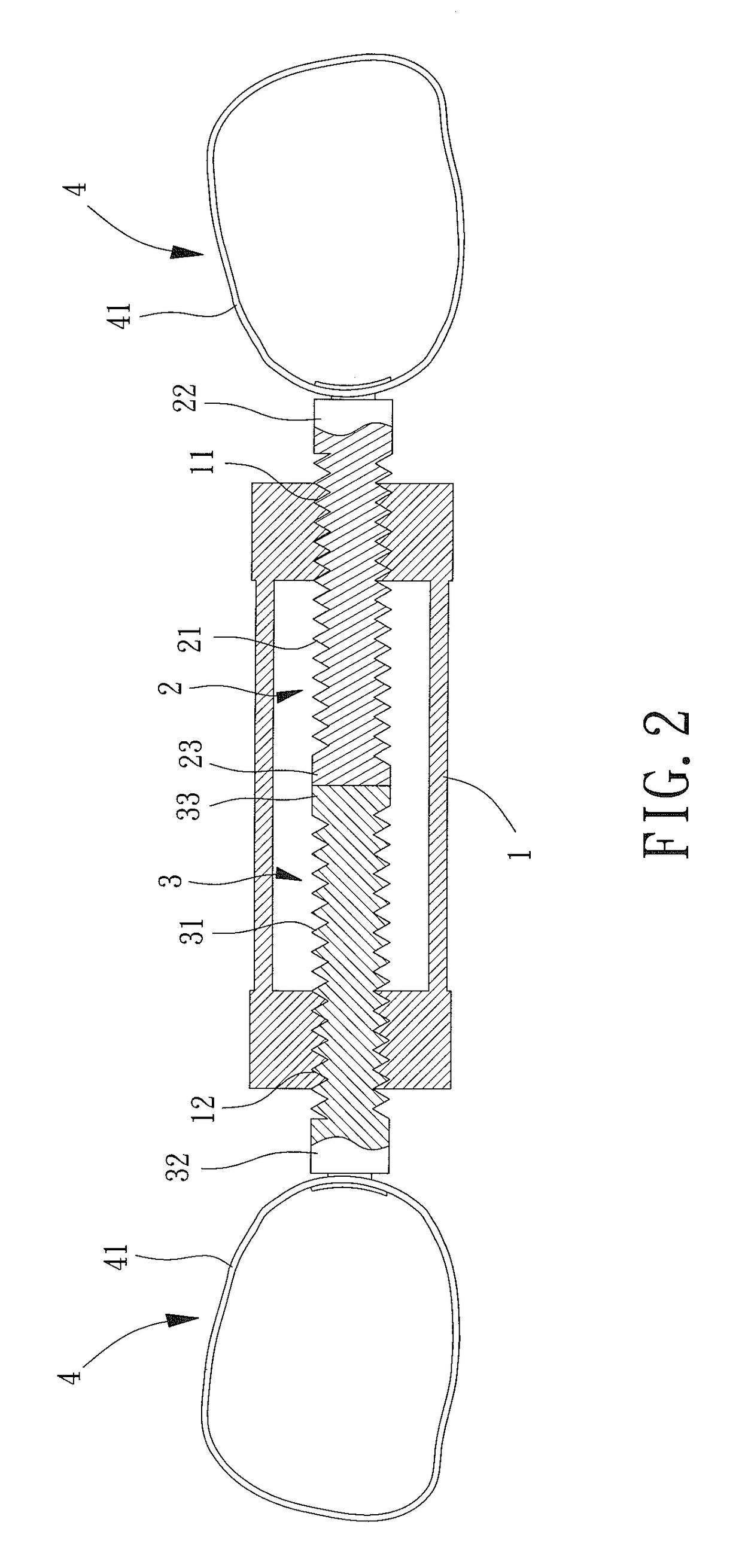 Orthodontic remodeling device