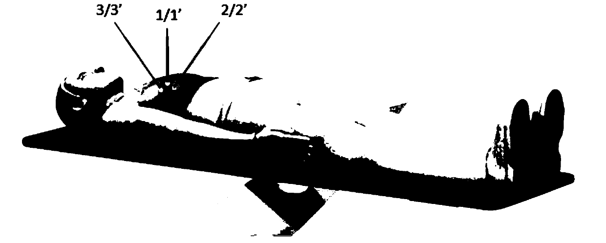 Location mark based radiotherapy positioning method