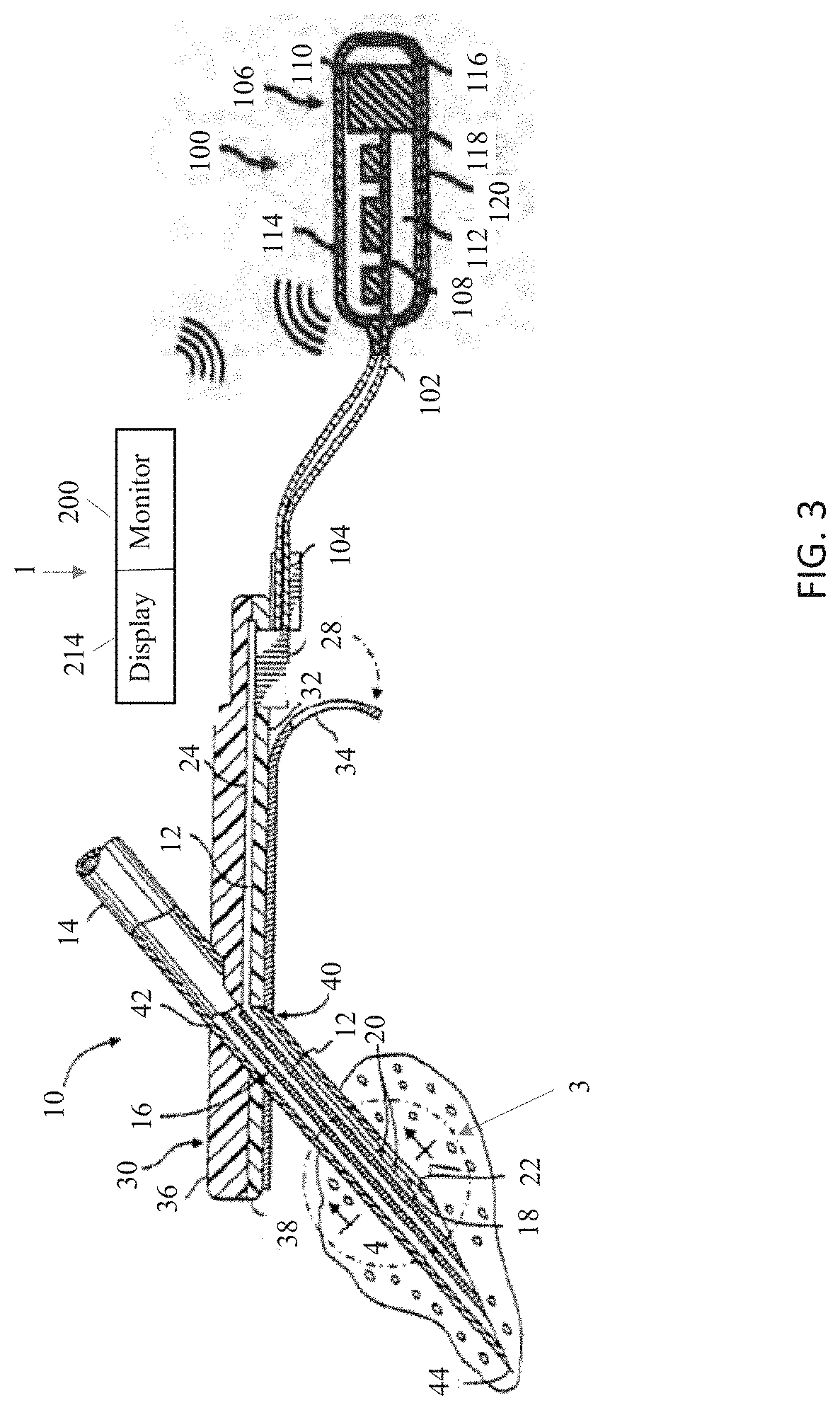 Metal pillar device structures and methods for making and using them in electrochemical and/or electrocatalytic applications