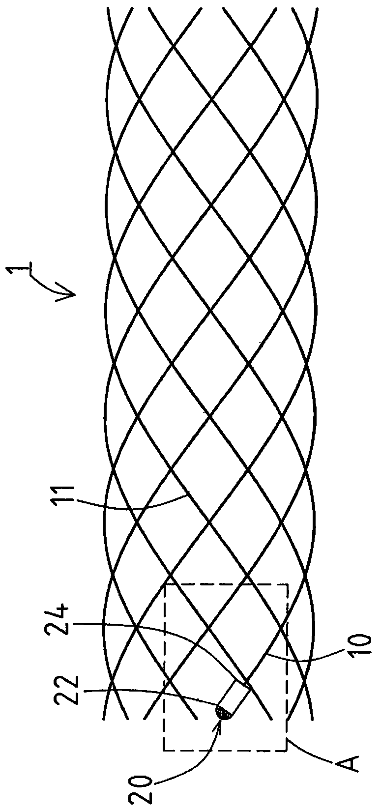 self-expanding stent