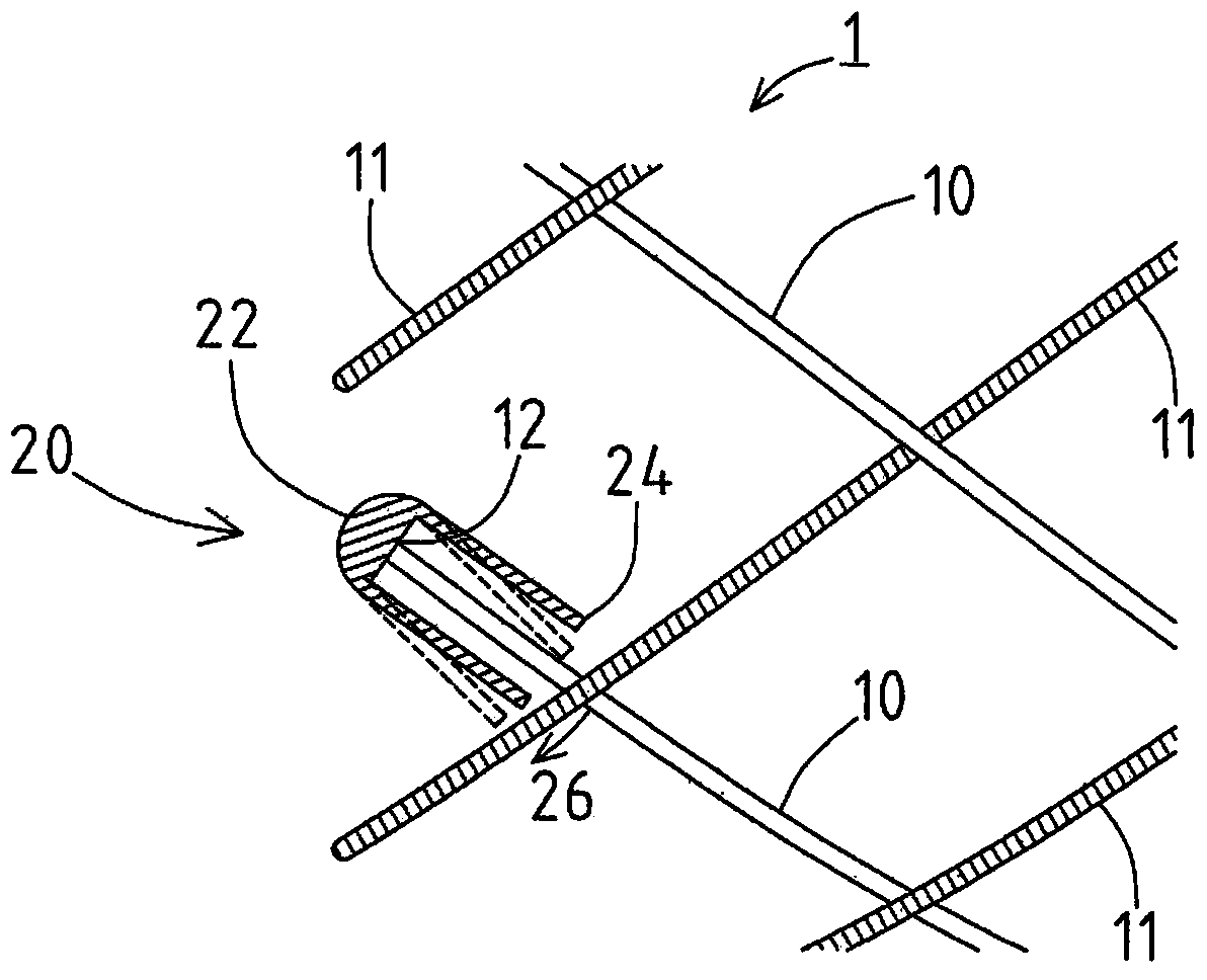 self-expanding stent