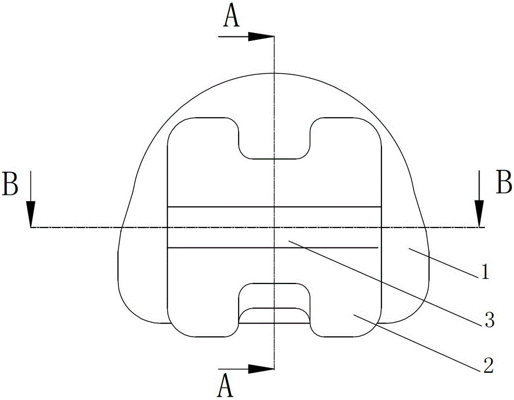 Self-ligating orthodontic brackets for orthodontics