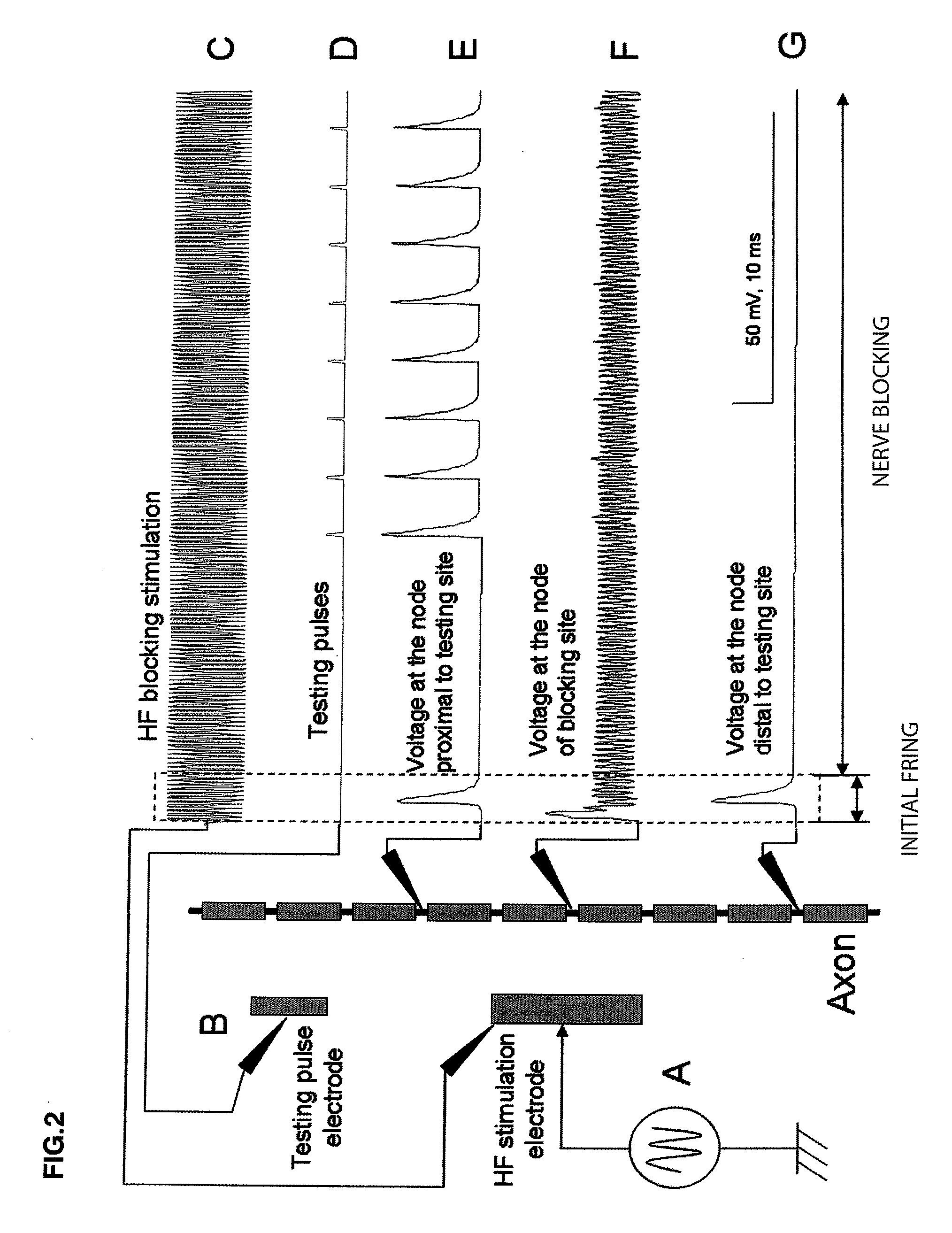 Energy efficient high frequency nerve blocking technique