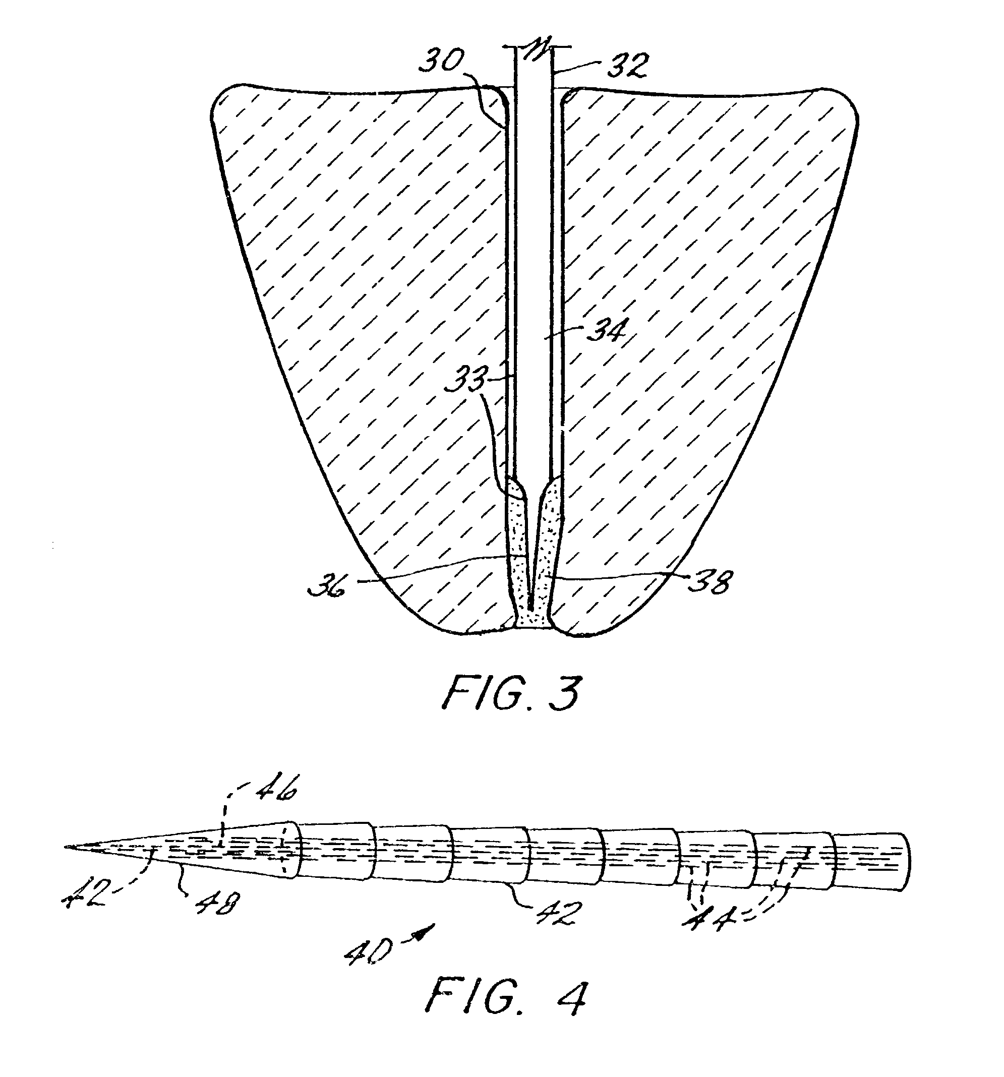 Endodontic post system