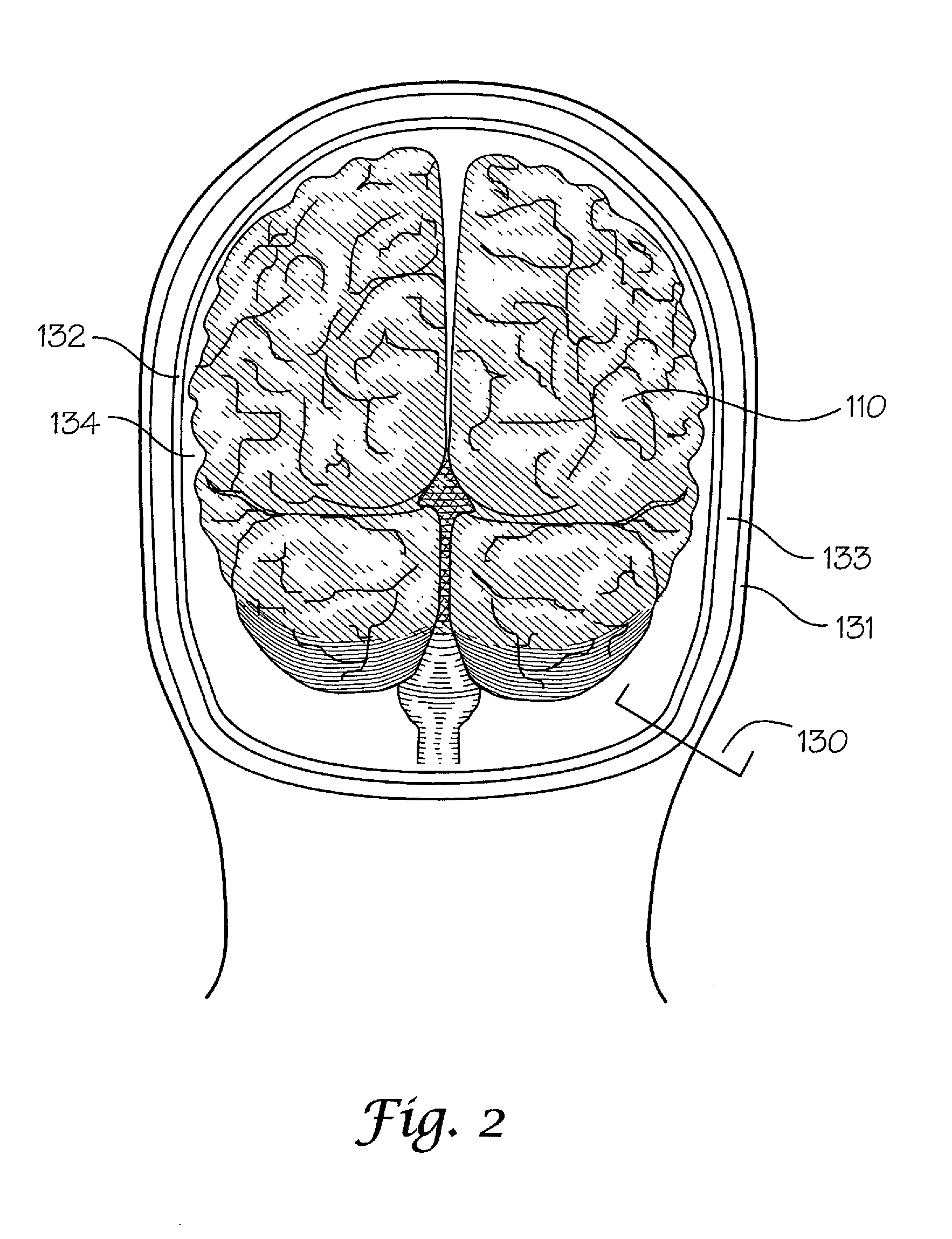 Dielectric properties models and methods of using same