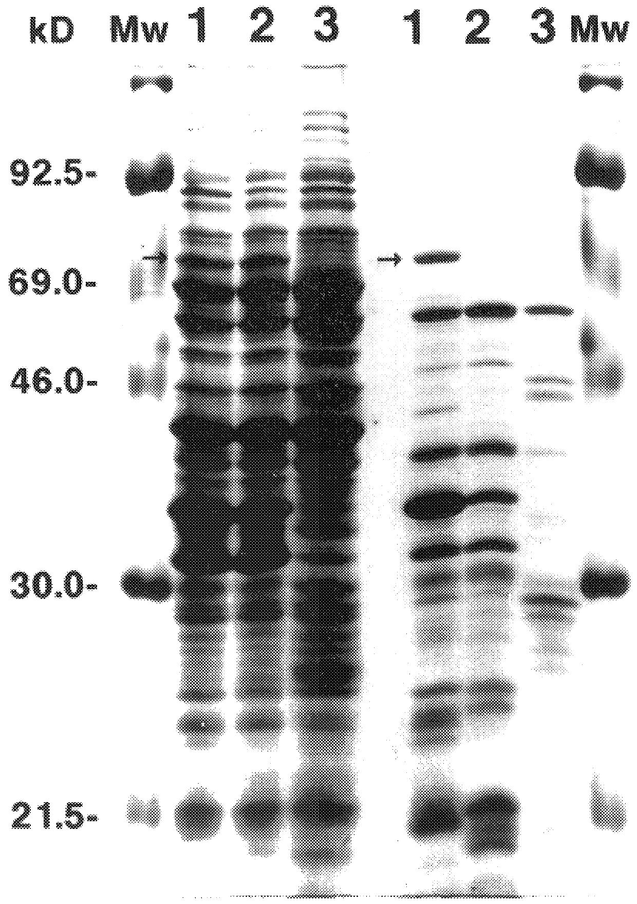 66 kDa antigen from Borrelia