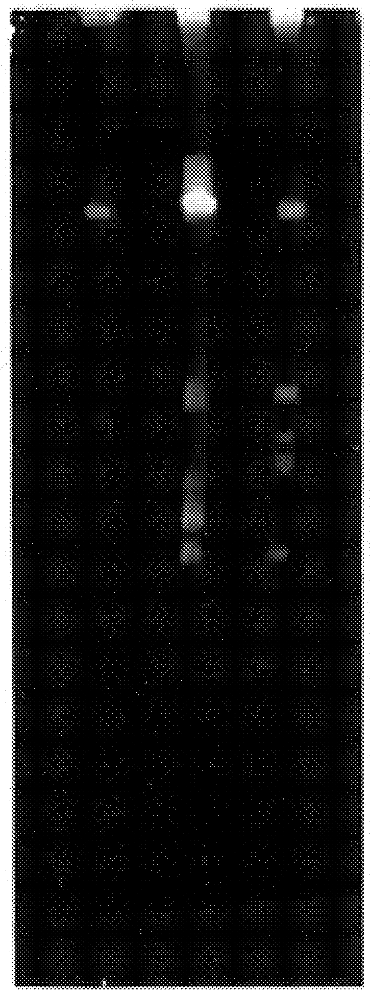 66 kDa antigen from Borrelia