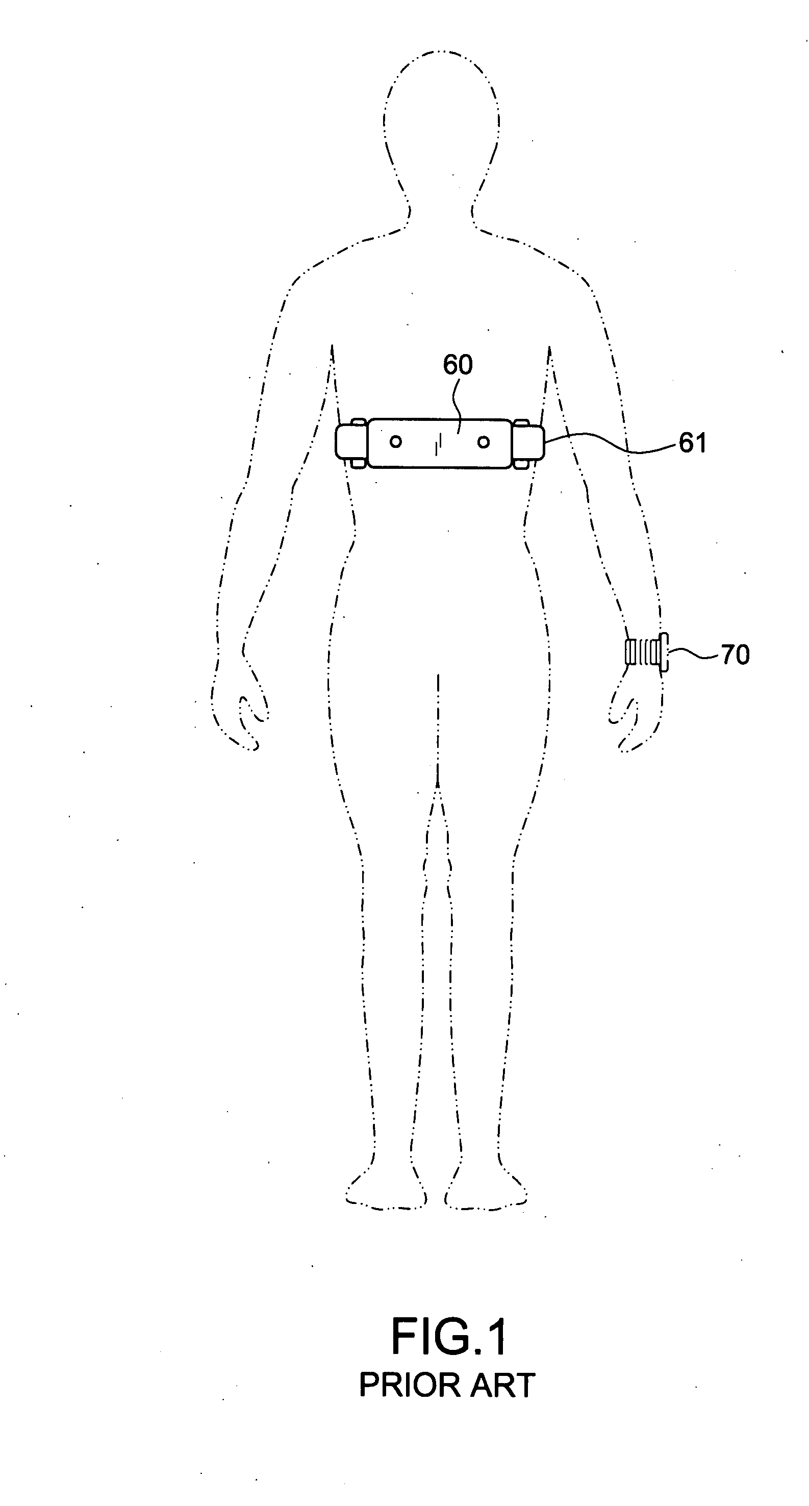 Finger-type pulse detection wireless transmission structure