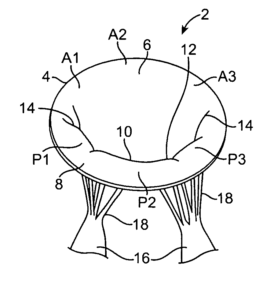 Devices and methods for repairing cardiac valves