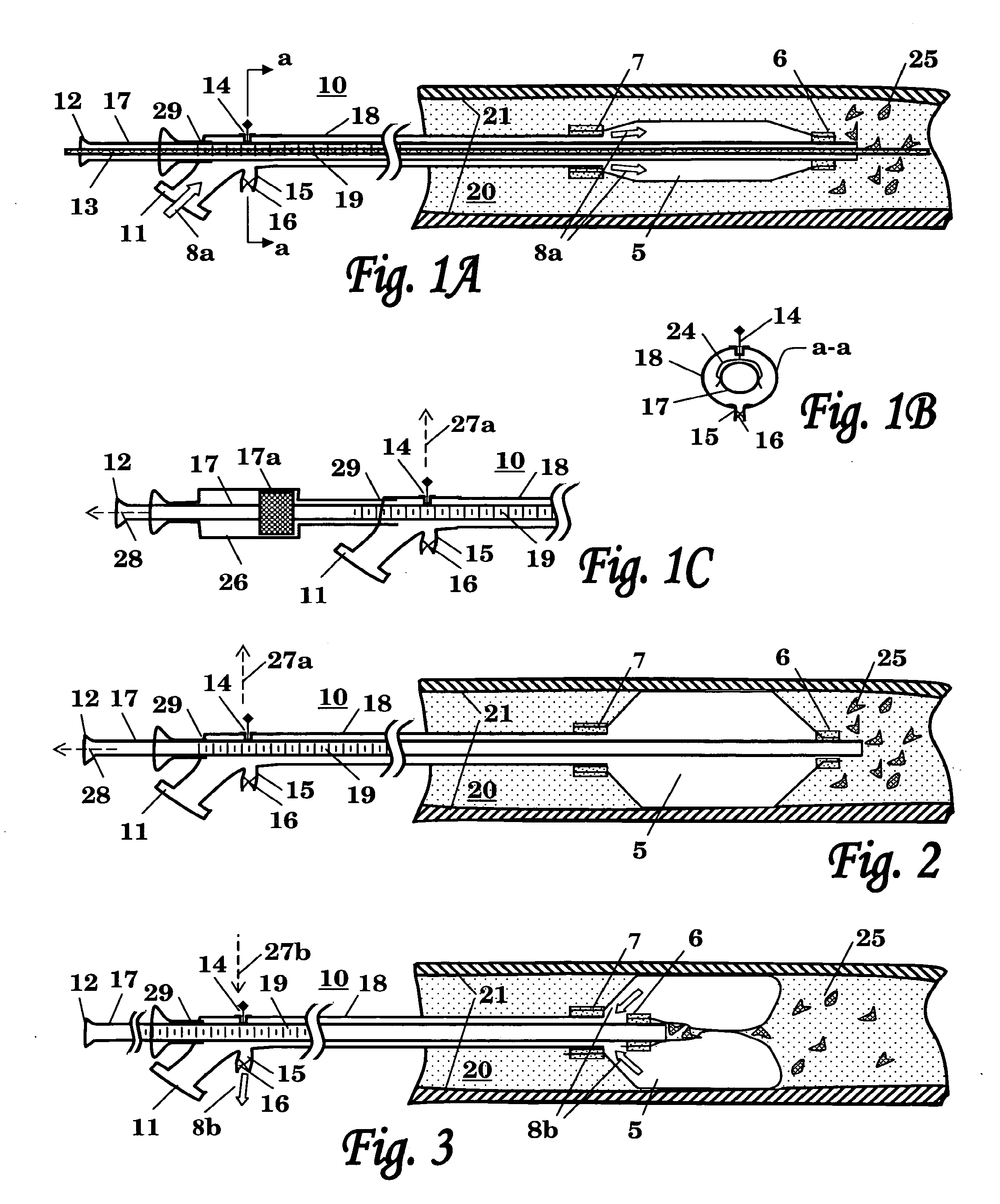 Balloon catheter