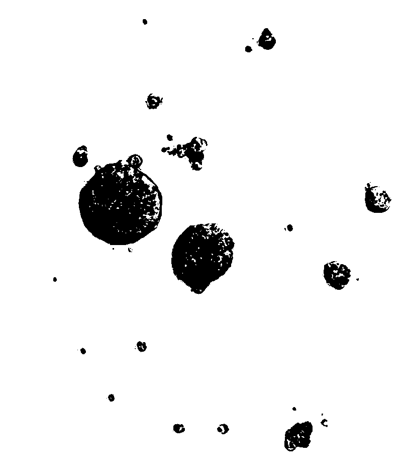 Method for preparing breast cancer bone metastasis organs