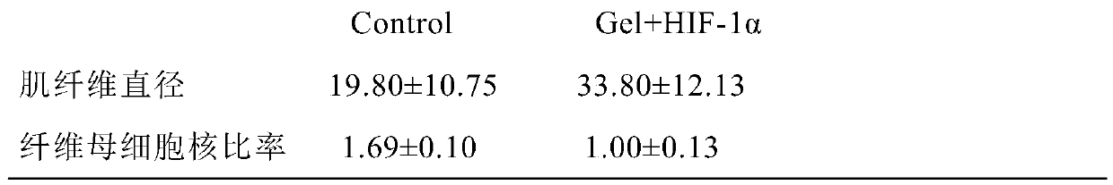 Hydrogel coated HIF-1 alpha overexpression lentiviral vector compound for repairing brachial plexus avulsion and preparation method