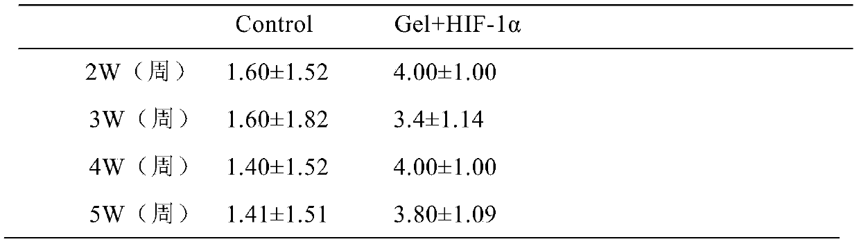 Hydrogel coated HIF-1 alpha overexpression lentiviral vector compound for repairing brachial plexus avulsion and preparation method