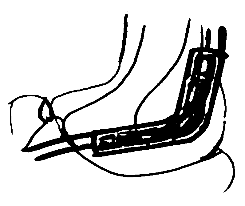 Flexible peripheral neurological deficit repairing duct and preparation method thereof