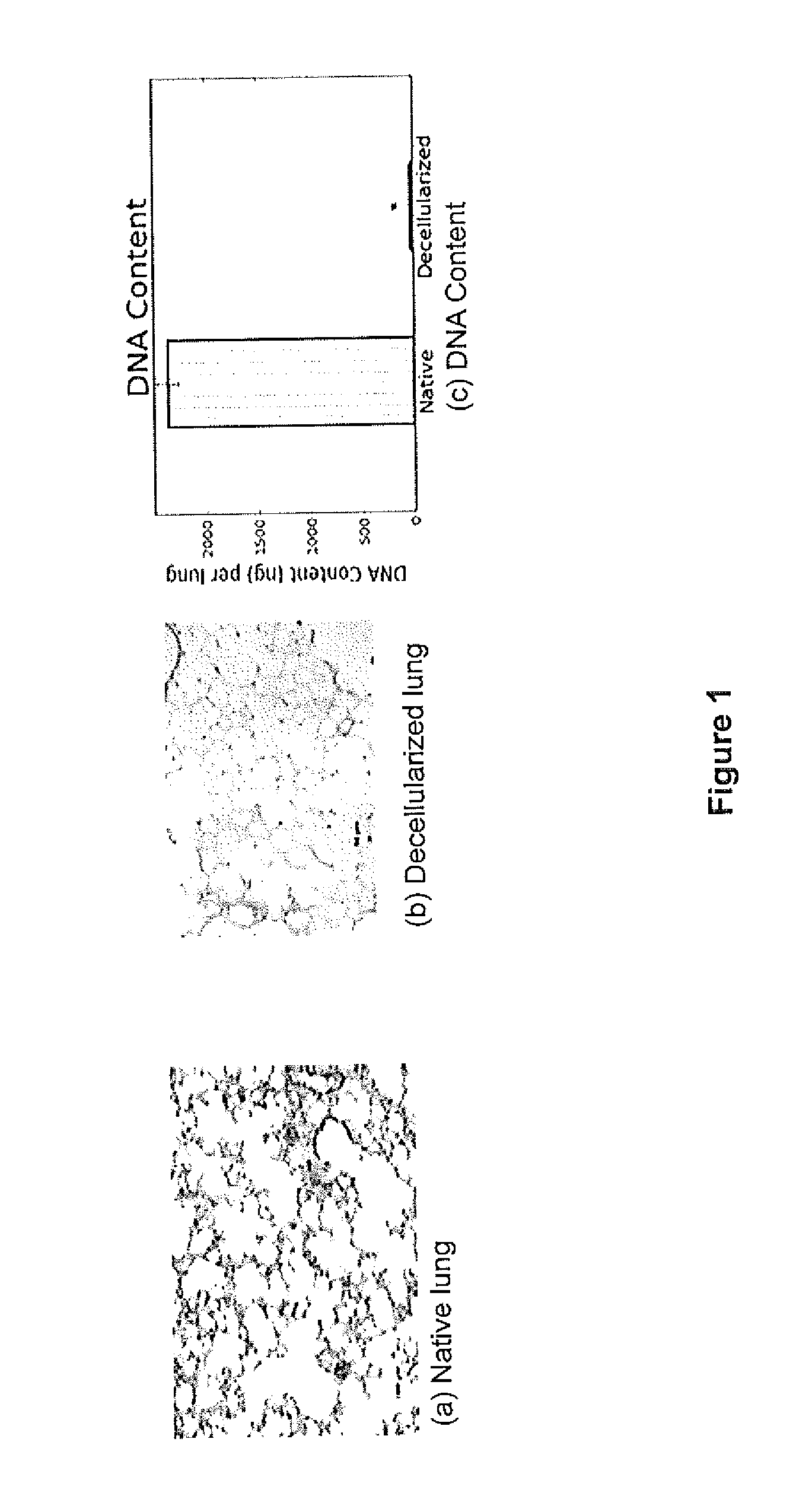 Tissue Engineering of Lung