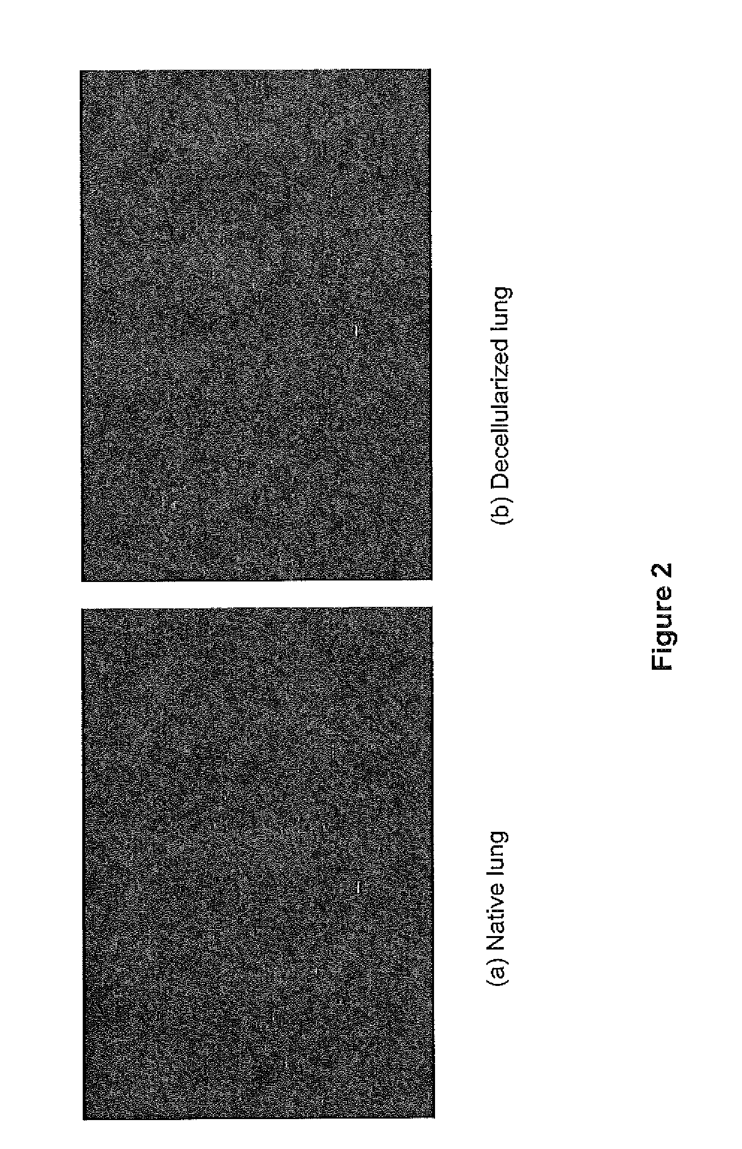 Tissue Engineering of Lung