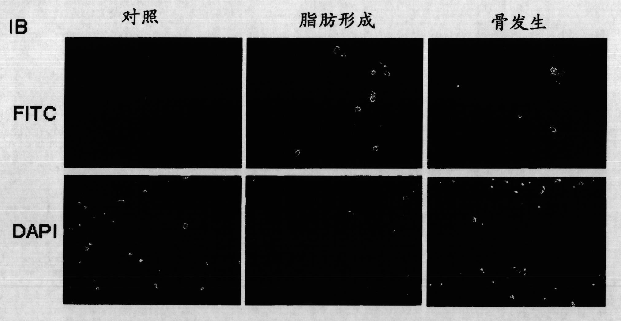 Method of increasing differentiation of chondrogenic progenitor cells