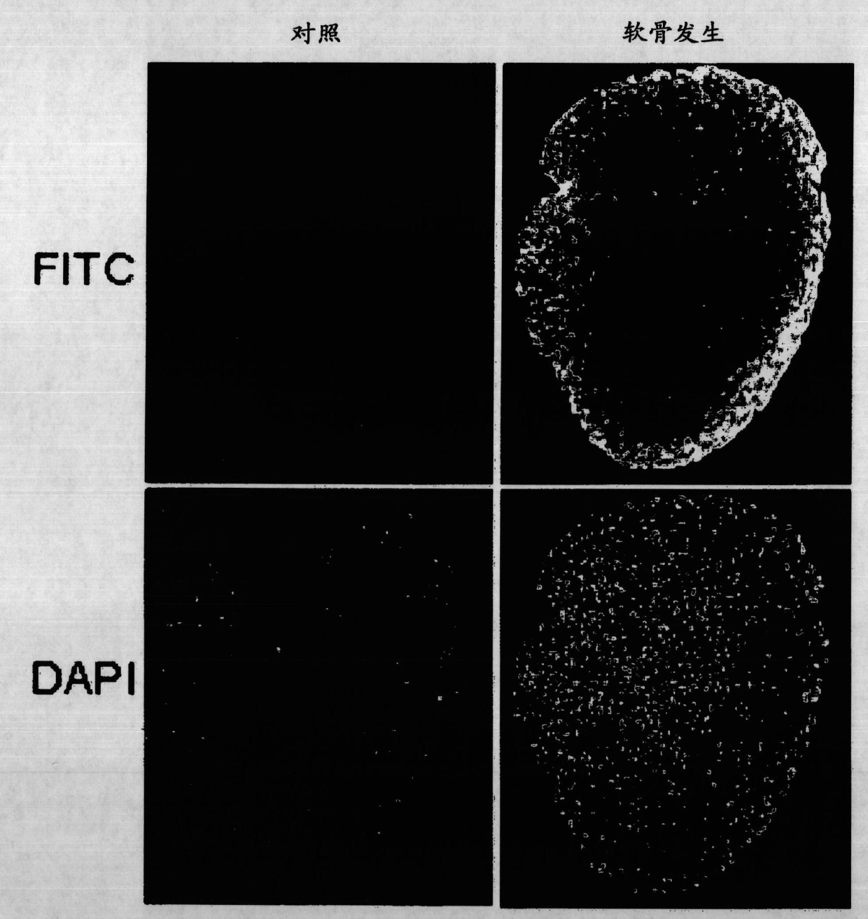 Method of increasing differentiation of chondrogenic progenitor cells