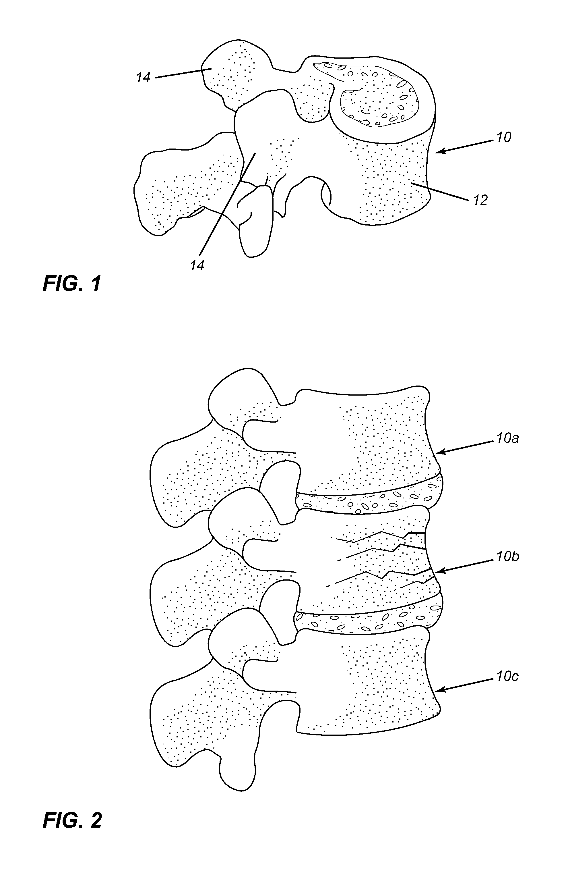 Minimally invasive method and applications for injectible materials