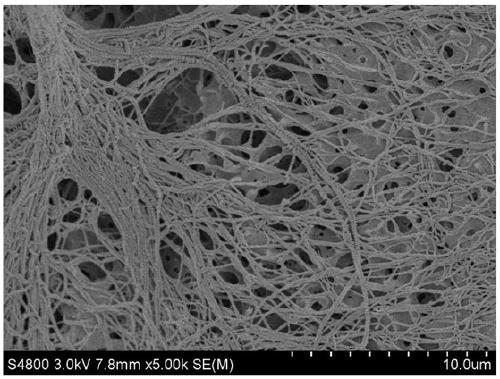 Ethylene-chlorotrifluor ethylene copolymer microporous separation membrane, preparation method and application thereof