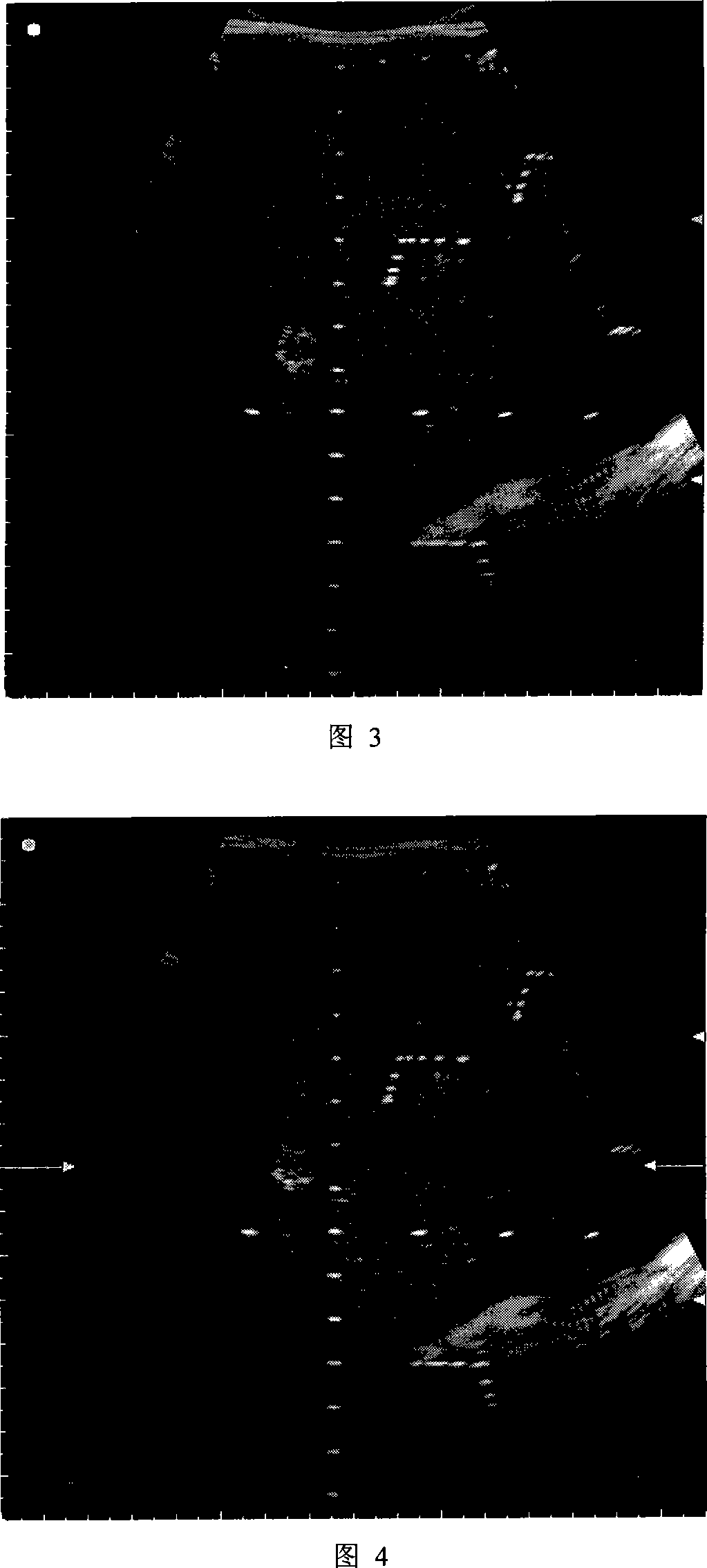 Method for connecting multi focal medical ultrasonic echogram